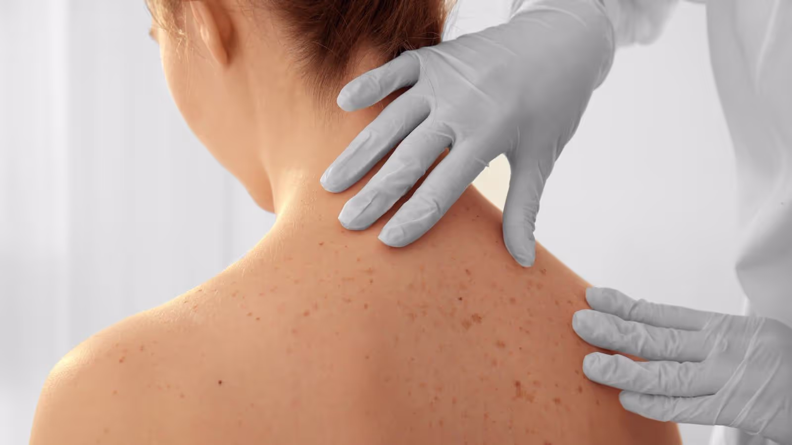 Dermatological Compounding: Personalized Solutions for Your Skin